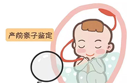 贵州省胎儿需要如何做亲子鉴定，贵州省无创孕期亲子鉴定大概多少费用